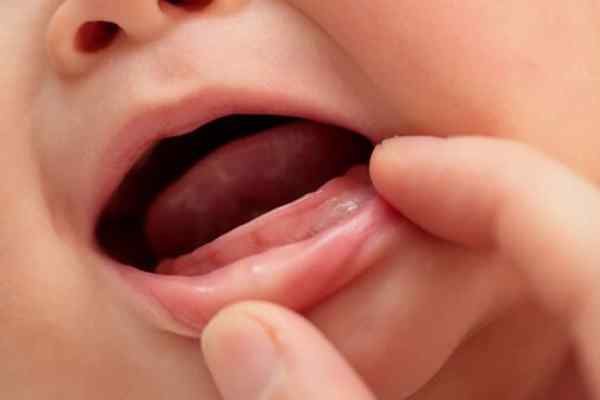 cách hạ sốt cho trẻ khi mọc răng